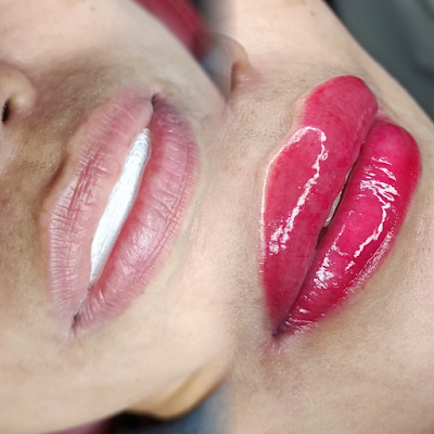Baby Lush Beauty Aesthetic Center
