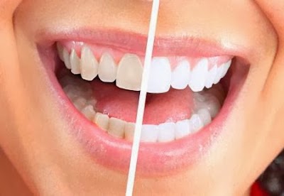 ERKER-SALCEDO DENTAL CLINIC